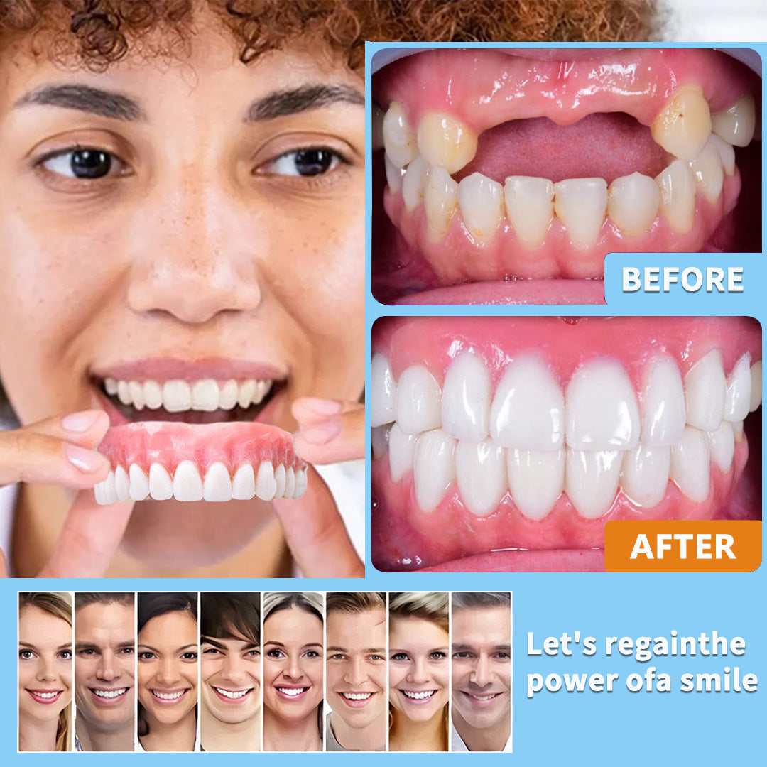 SMILE HZA™ Premium Zahnprothese – Natürliches Lächeln & perfekter Sitz
