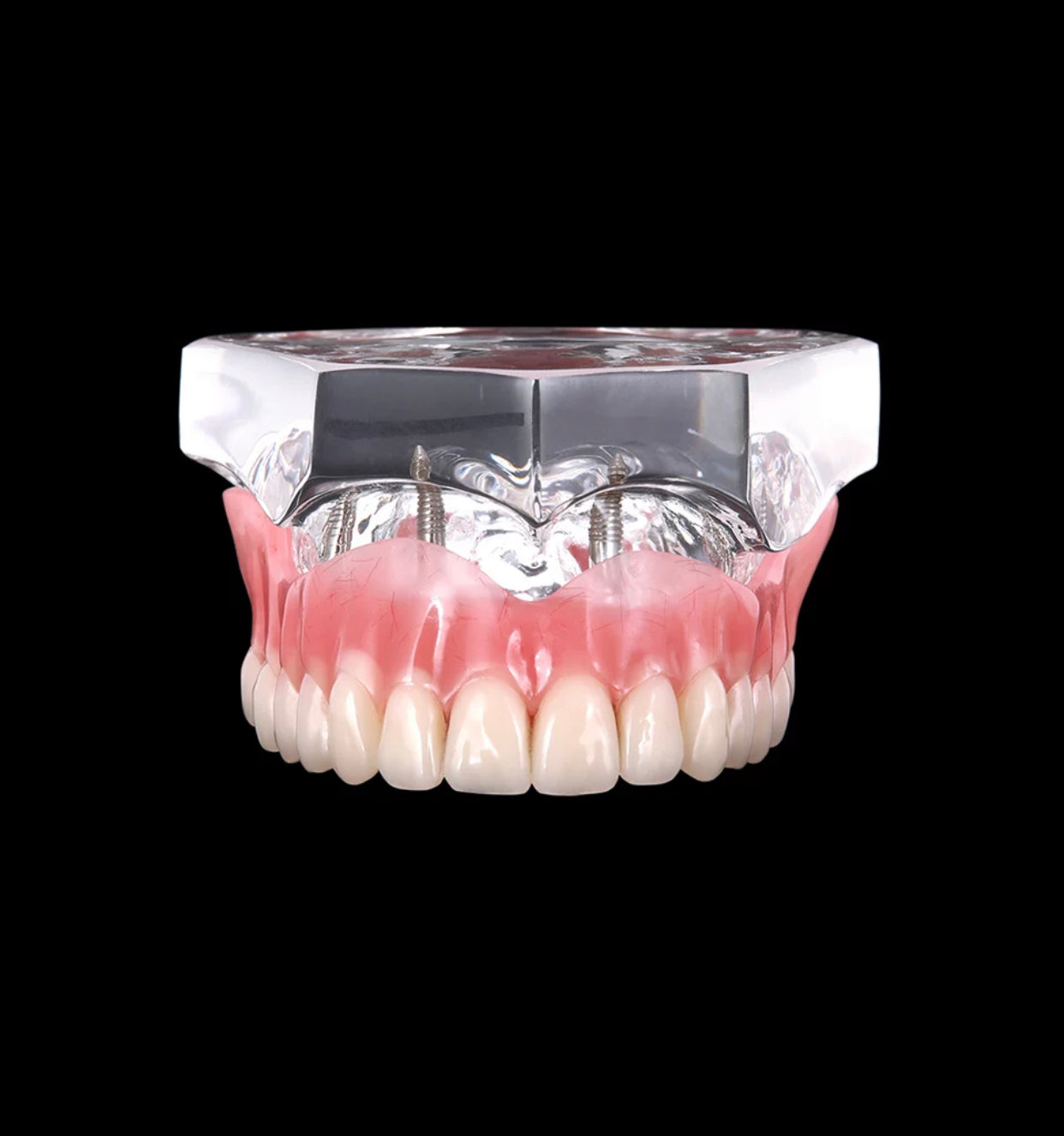 Zahnprothese Totalprothese Oberkiefer Demo Modell Gebiss