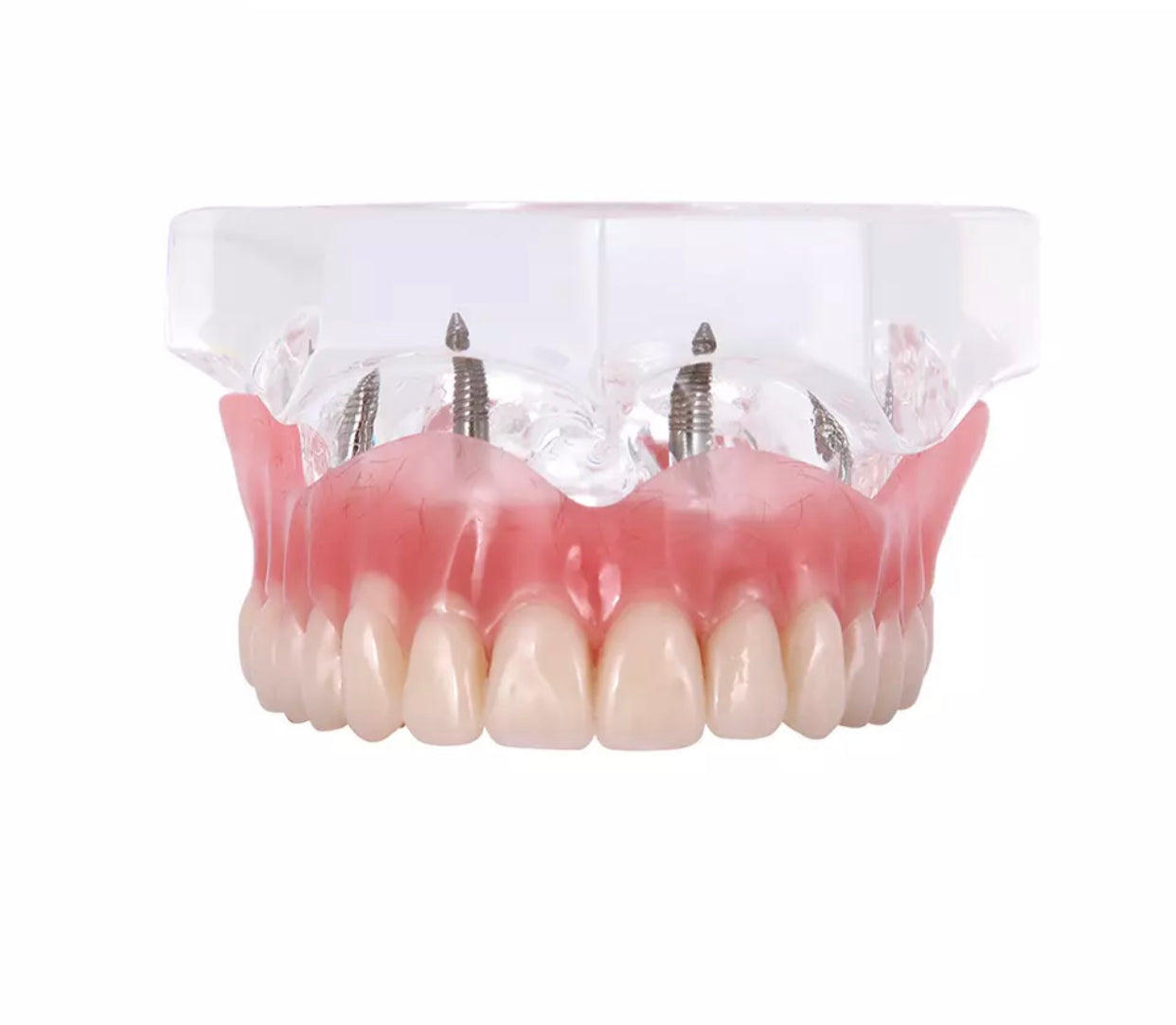Zahnprothese Totalprothese Oberkiefer Demo Modell Gebiss