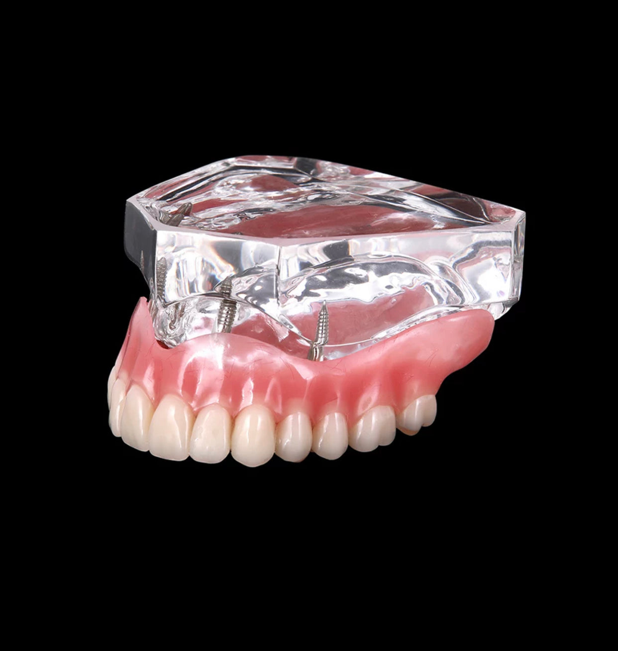 Zahnprothese Totalprothese Oberkiefer Demo Modell Gebiss