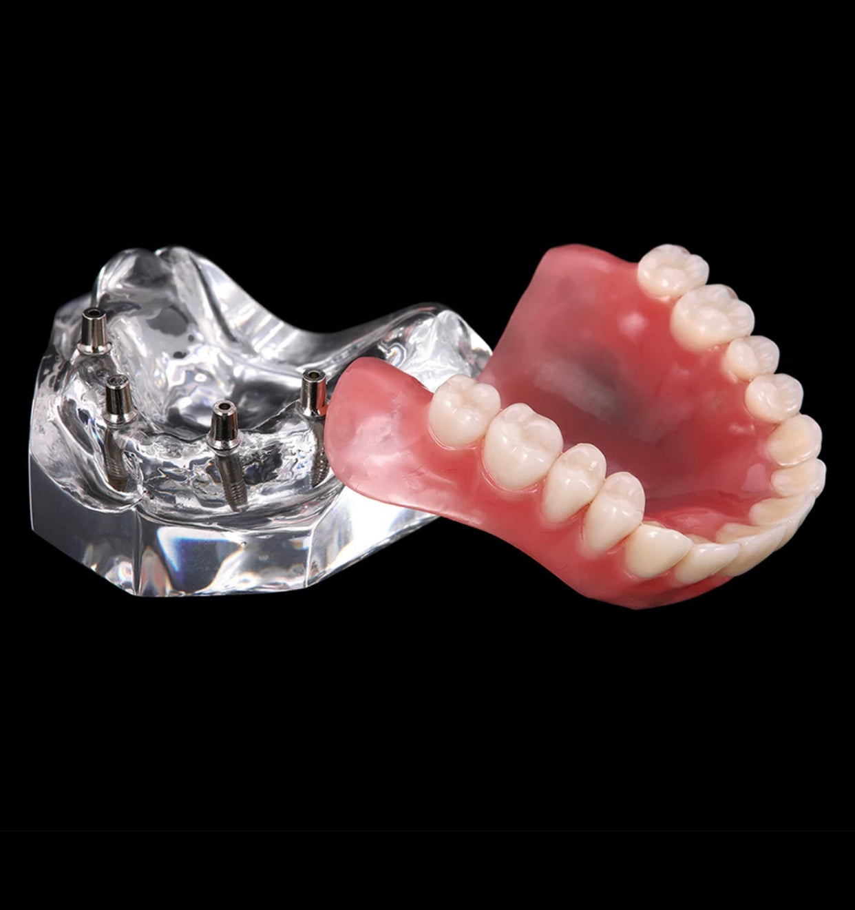 Zahnprothese Totalprothese Oberkiefer Demo Modell Gebiss