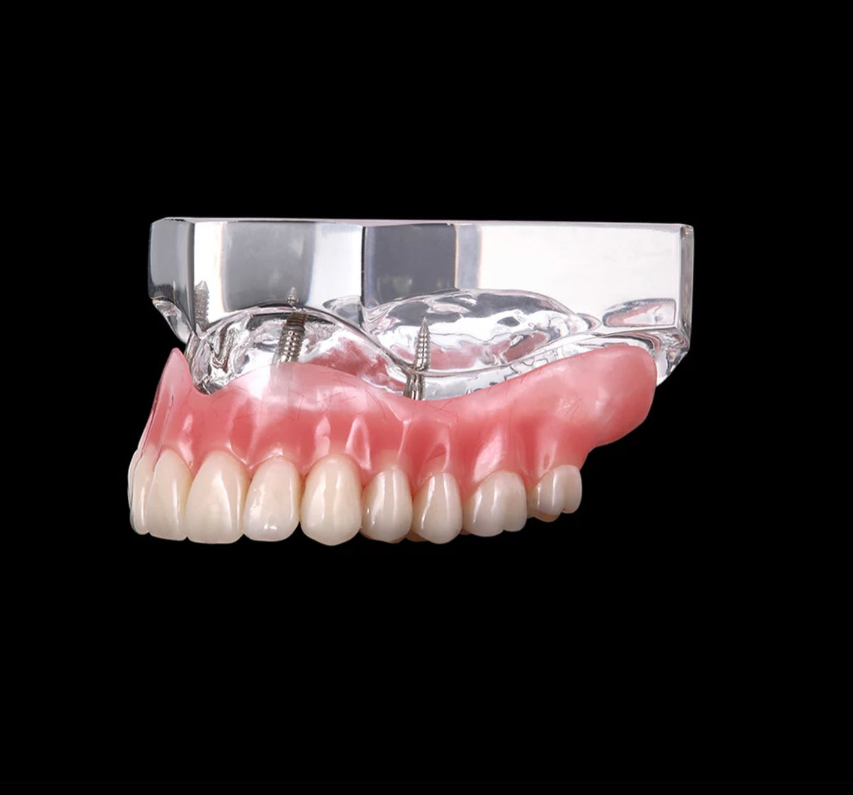 Zahnprothese Totalprothese Oberkiefer Demo Modell Gebiss