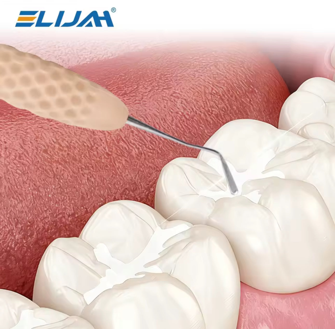 Dental Komposit Instrumenten Set CT1–CT7