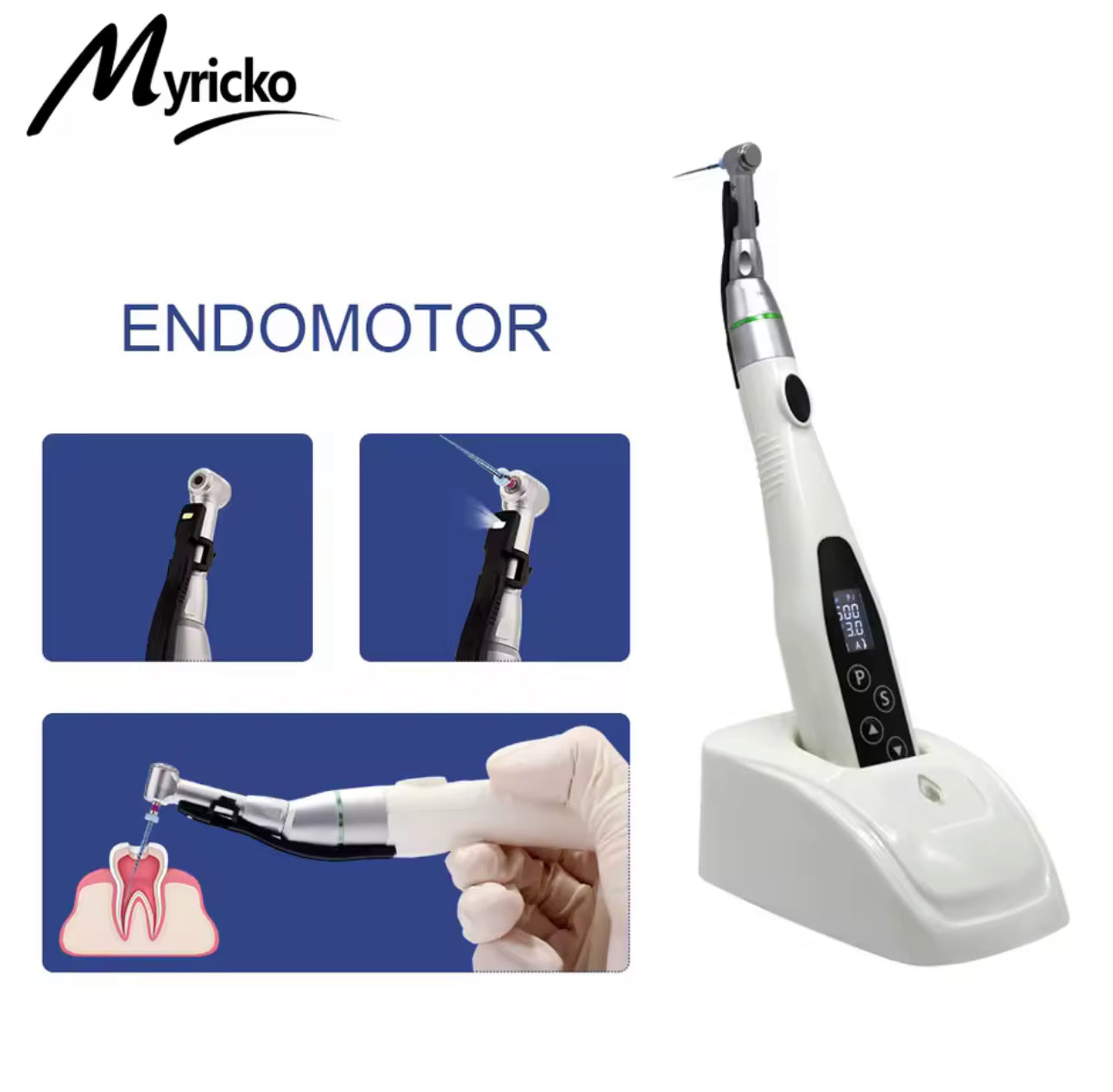 Kabelloser EndoMotor 16:1 – LED-Endomotor für Wurzelkanalbehandlungen | Hochdrehmoment, 6 Arbeitsmodi, 360° Rotation