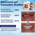 Premium Zahnverblendung – Verblendung Natürliches Lächeln & perfekter Sitz