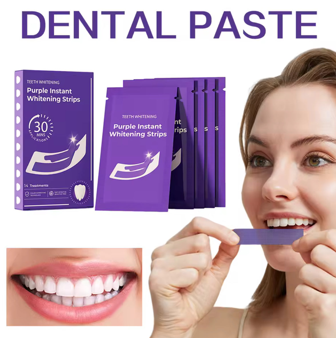 Lila Zahnaufhellungsstreifen – Sofortige Farbkorrektur für sichtbar hellere Zähne (14 Paare)